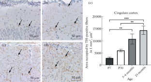 Catecholaminergic Rat’s Forebrain Structures in Early Postnatal Development and Aging