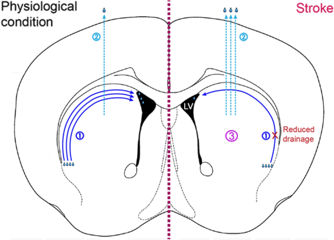 Effects of Ischemic Stroke on Interstitial Fluid Clearance in Mouse Brain: a Bead Study.