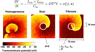 Impact of noise on the instability of spiral waves in stochastic 2D mathematical models of human atrial fibrillation