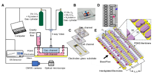 Rapid electrical impedance detection of sickle cell vaso-occlusion in microfluidic device