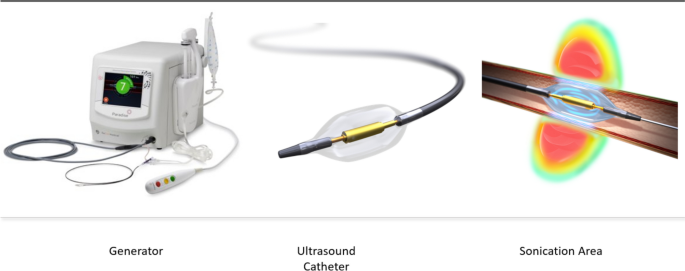 Real-world experience with ultrasound renal denervation utilizing home blood pressure monitoring: the Global Paradise System registry study design.