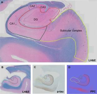 Predictors of hippocampal tauopathy in people with and at risk for human immunodeficiency virus infection.