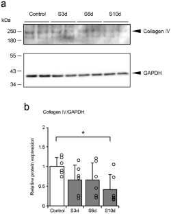 Effects of stretching on the basement membrane structure in the soleus muscle of Wistar rats.