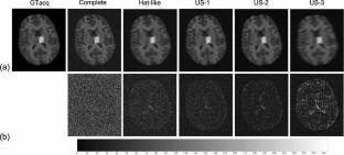 Learning to deep learning: statistics and a paradigm test in selecting a UNet architecture to enhance MRI.