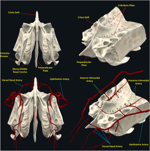 Examination of ethmoidal roof regarding Keros and Yenigun classifications in a Turkish population: a computerized tomography study