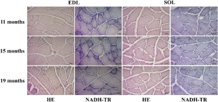 How soon do metabolic alterations and oxidative distress precede the reduction of muscle mass and strength in Wistar rats in aging process?