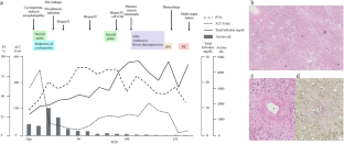 Early-onset hepatic veno-occlusive disease after liver transplantation: an institutional experience and analysis of a literature-based cohort.