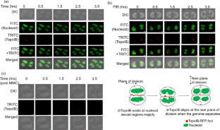 Differential cellular localization of DNA gyrase and topoisomerase IB in response to DNA damage in Deinococcus radiodurans