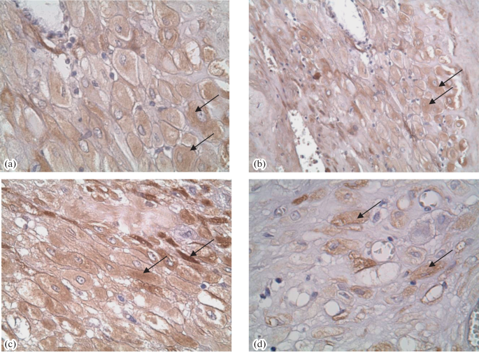 Morfofunctional and Molecular Changes in Placenta and Peripheral Blood in Preeclampsia and Gestational Diabetes Mellitus