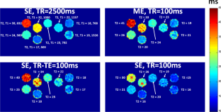 A short-TR single-echo spin-echo breath-hold method for assessing liver T2