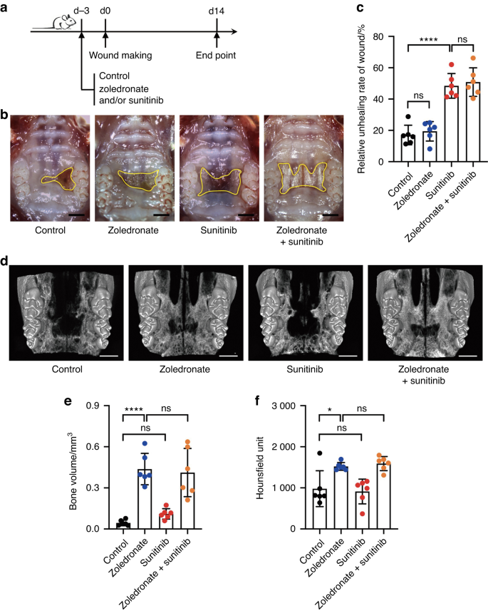 Oral administration of Bifidobacterium breve improves anti-angiogenic drugs-derived oral mucosal wound healing impairment via upregulation of interleukin-10