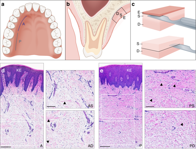 Differential molecular profiles and associated functionalities characterize connective tissue grafts obtained at different locations and depths in the human palate