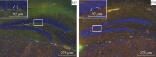 Neurogenesis in Neurogenic Niches of the Brain in Experimental Alzheimer’s Disease at the Presymptomatic Stage of Neurodegeneration Development