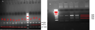 Serum and salivary Cu/Zn ratio as a diagnostic biomarker for oral submucosal fibrosis: an analysis of trace metals and LOX gene variants