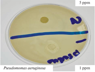 Evaluation of Flavonoid Extract of Laurus nobilis Leaves as Corrosion Inhibitor for Pipelines of Reverse Osmosis Water and Study of Its Effects on Liver Enzymes and Hematological Parameters