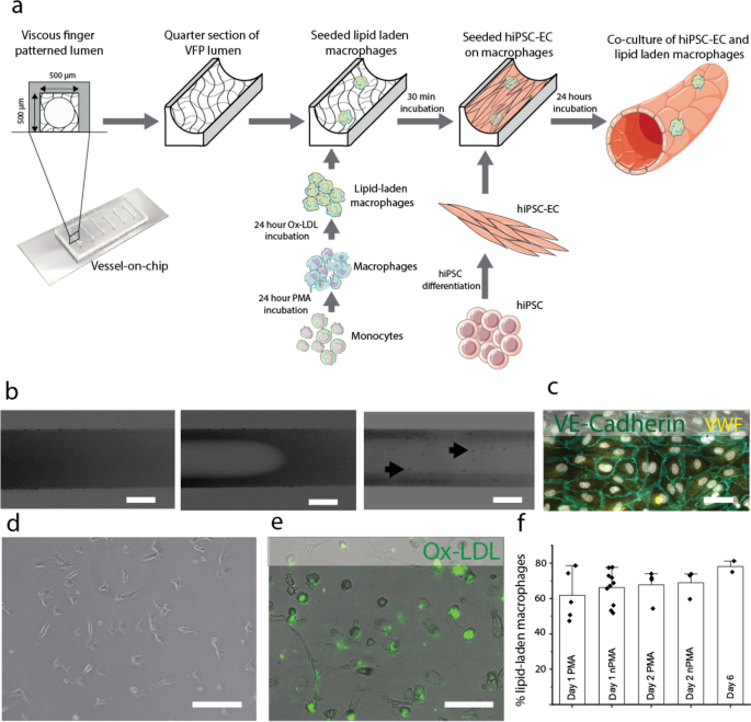 Embedded macrophages induce intravascular coagulation in 3D blood vessel-on-chip