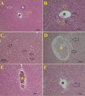 Acute and subacute toxic effects of CUMYL-4CN-BINACA on male albino rats