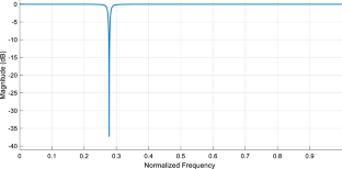 Powerline interference reduction in ECG signals using variable notch filter designed via variational mode decomposition