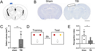 Overexpress miR-132 in the Brain Parenchyma by a Non-invasive Way Improves Tissue Repairment and Releases Memory Impairment After Traumatic Brain Injury