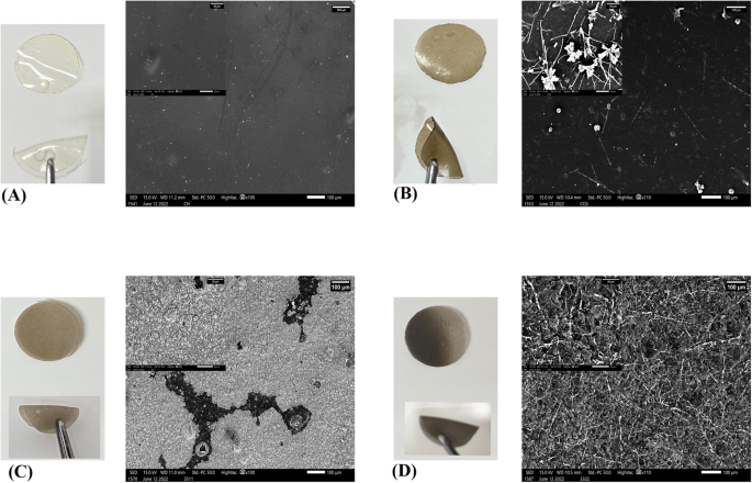 The potential of nano graphene oxide and chlorhexidine composite membranes for use as a surface layer in functionally graded membranes for periodontal lesions