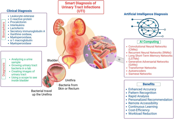 Smart Diagnosis of Urinary Tract Infections: is Artificial Intelligence the Fast-Lane Solution?