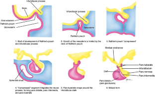 Diagnosing and treating anterior pituitary hormone deficiency in pediatric patients