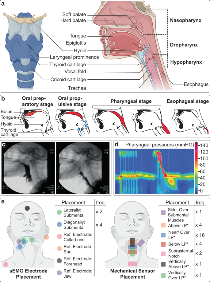 Wearable, epidermal devices for assessment of swallowing function