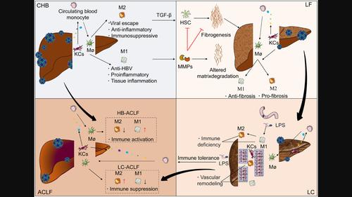 From hepatitis B virus infection to acute-on-chronic liver failure: The dynamic role of hepatic macrophages