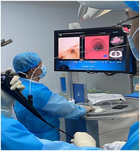 Preoperative pulmonary nodule localization: A comparison of hook wire and Lung-pro-guided surgical markers