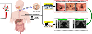 Refining postoperative monitoring of recurrent laryngeal nerve injury in esophagectomy patients through transcutaneous laryngeal ultrasonography.