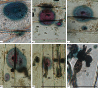 Effect of Metabolic Inhibitors on the Size and Structure of Halos Induced by the Powdery Mildew Pathogen Blumeria graminis f. sp. tritici on Wheat Leaves