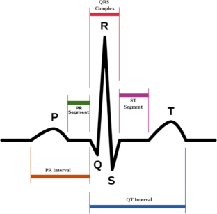 Automatic ECG classification using discrete wavelet transform and one-dimensional convolutional neural network