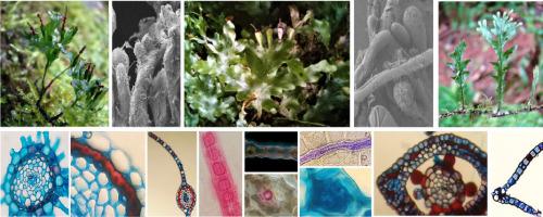 Comparative morpho-anatomy of the sporophyte of the most austral American species of Didymoglossum (Polypodiopsida: Hymenophyllaceae)