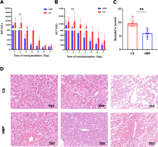 Hypothermic machine perfusion reduces donation after circulatory death liver ischemia-reperfusion injury through the SERPINA3-mediated PI3Kδ/Akt pathway.