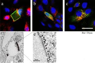 Lysosomal sialidase NEU1, its intracellular properties, deficiency, and use as a therapeutic agent.