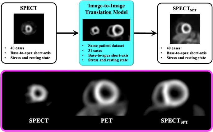 Deep learning approach using SPECT-to-PET translation for attenuation correction in CT-less myocardial perfusion SPECT imaging.