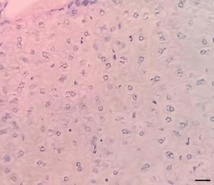 Optimization of PAS stain and similar Schiff's based methods for glycogen demonstration in liver tissue.