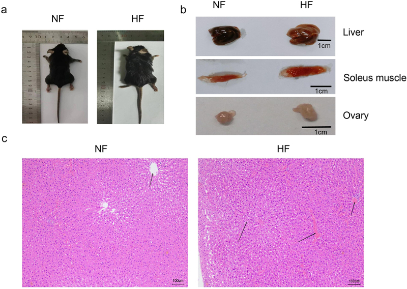 Changes of insulin receptors in high fat and high glucose diet mice with insulin resistance.