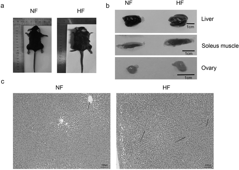 Changes of insulin receptors in high fat and high glucose diet mice with insulin resistance.