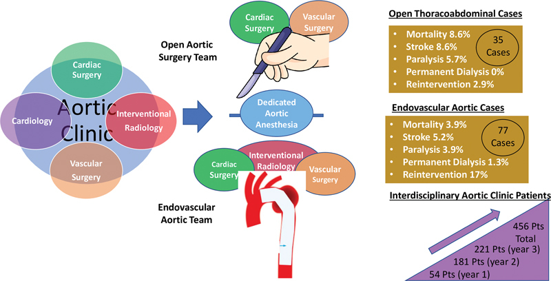 The Aortic Team Model for the Management of the Distal Arch, Descending Thoracic and Thoracoabdominal Aorta: Appraisal at 3 Years.