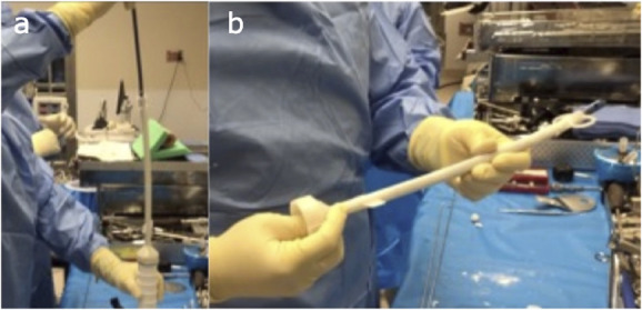 Antibiotic cement nails manufactured with threaded rods or cannulated intramedullary nails are better than those made with guidewires and do not debond.
