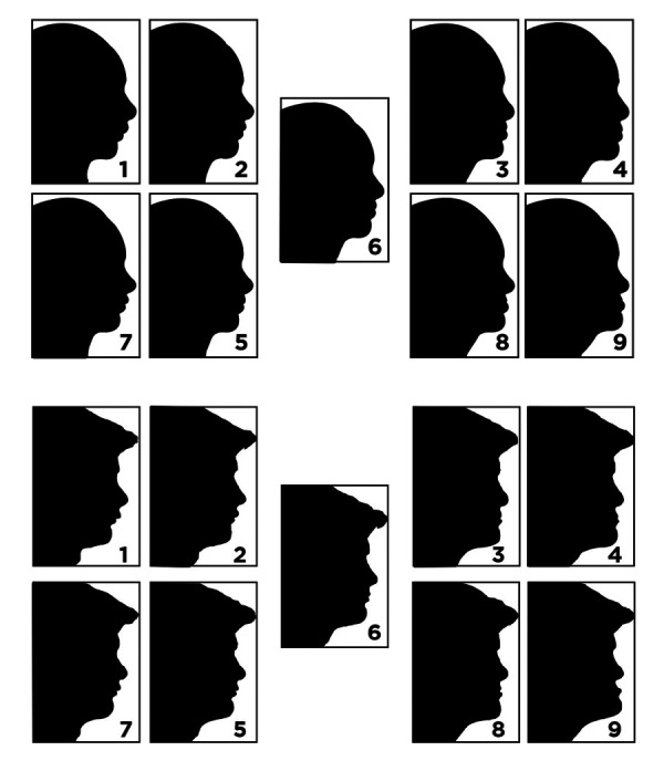 [Aesthetic preferences of individuals when evaluating photographs of facial profiles with different sagittal and vertical growth patterns. A cross-sectional study].