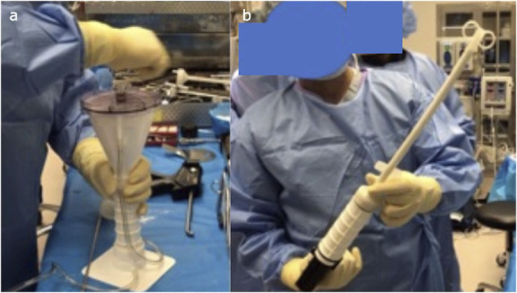 Antibiotic cement nails manufactured with threaded rods or cannulated intramedullary nails are better than those made with guidewires and do not debond.