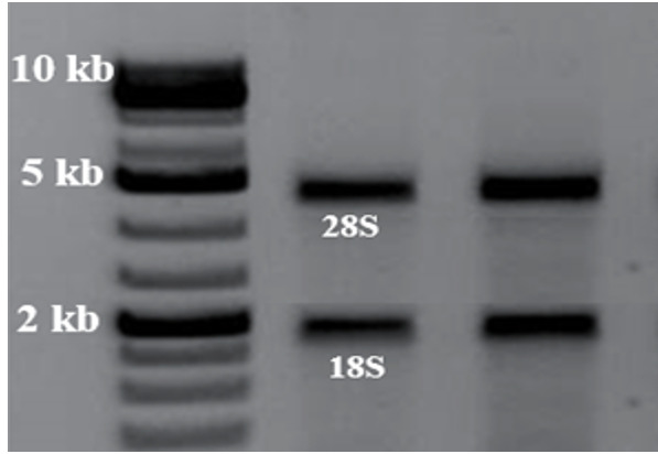 Quantitative Assessment of PALB2 and BRIP1 Genes Expression in the Breast Cancer Cell Line under the Influence of Tamoxifen.