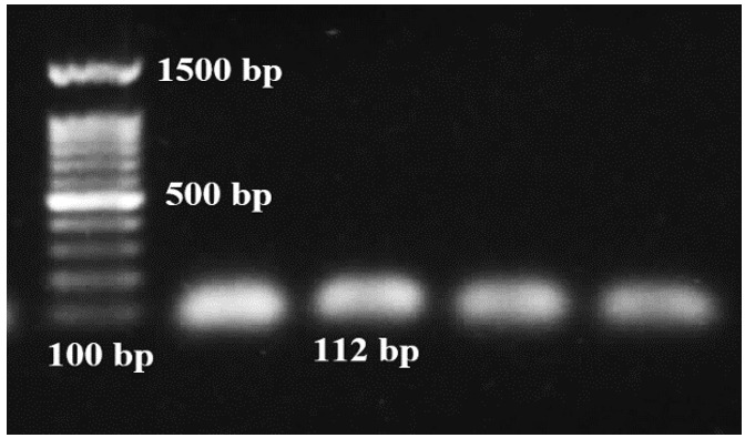 Quantitative Assessment of PALB2 and BRIP1 Genes Expression in the Breast Cancer Cell Line under the Influence of Tamoxifen.