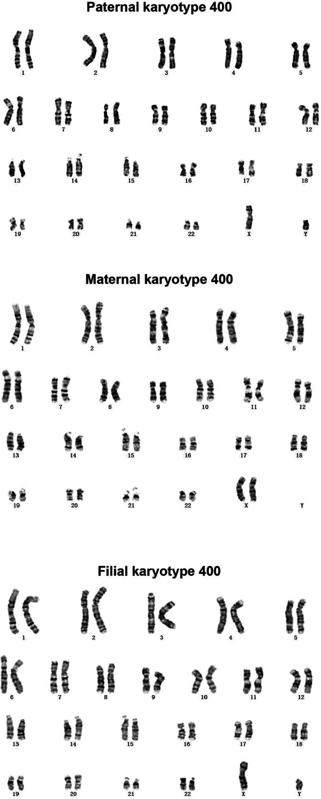 T2T-YAO: A Telomere-to-telomere Assembled Diploid Reference Genome for Han Chinese