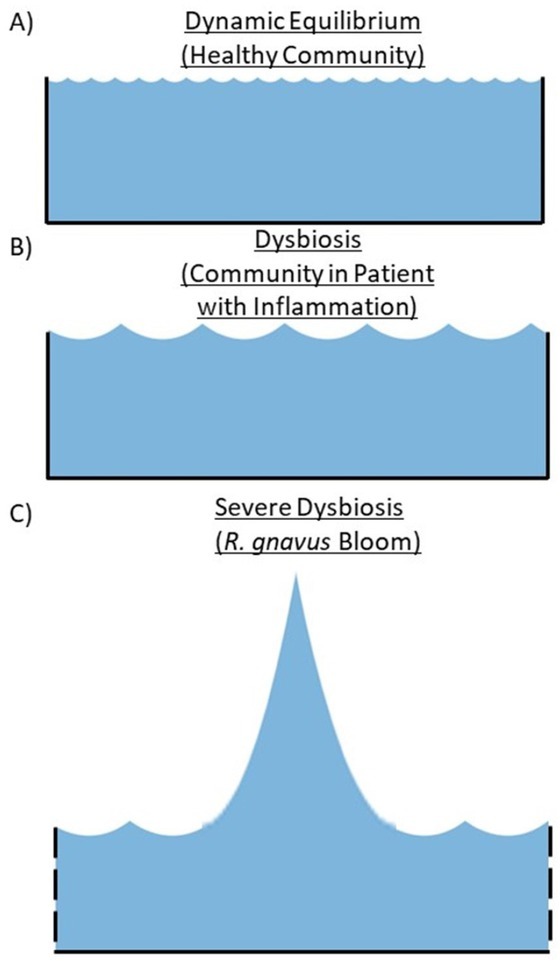 Understanding the roles of the microbiome in autoimmune rheumatic diseases.