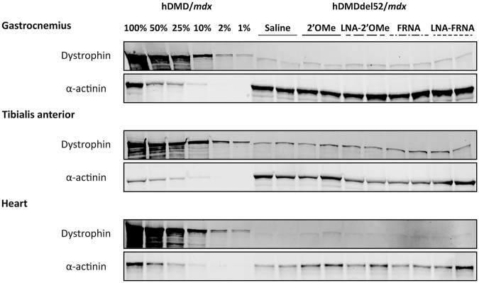 Challenges of Assessing Exon 53 Skipping of the Human <i>DMD</i> Transcript with Locked Nucleic Acid-Modified Antisense Oligonucleotides in a Mouse Model for Duchenne Muscular Dystrophy.