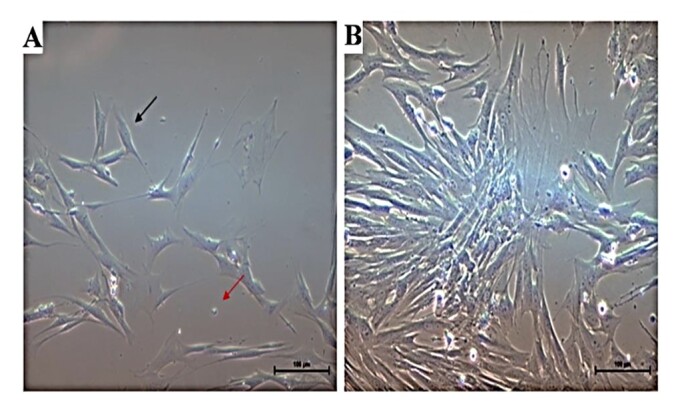 Addition of synthetic polymer in the freezing solution of mesenchymal stem cells from equine adipose tissue as a future perspective for reducing of DMSO concentration.