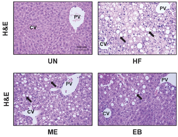 A sport supplement candidate of Erigeron breviscapus extract regulates lipogenesis in vitro and in vivo.